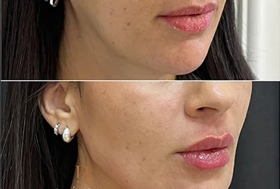 Comparativo antes e depois de paciente da Rhévora, imagem 12